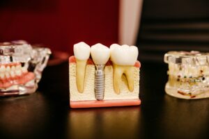 Adult patient receiving a dental implant examination while a dentist checks the gumline and restoration.